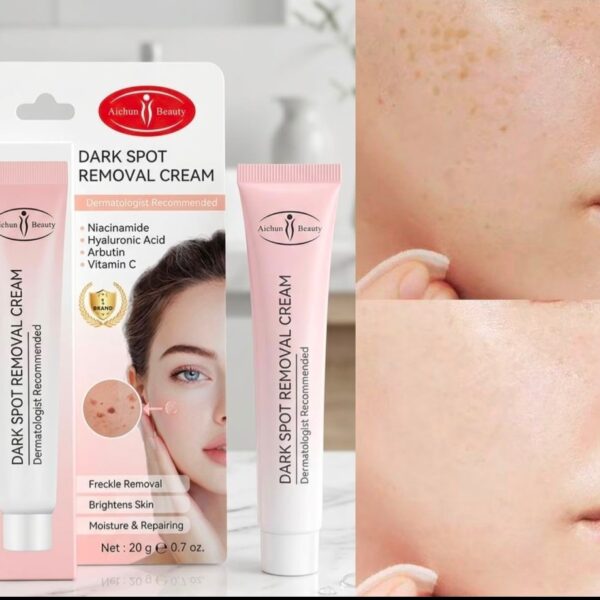 Dark Spots and Achieve Radiant Skin with Beauty Dark Spot Removal Cream